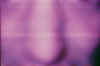 nose.jpg (62229 bytes)